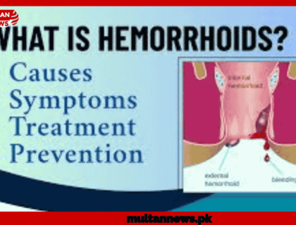HEMORRHOIDS